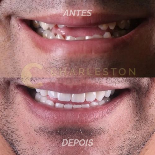 charleston odontologia (6)